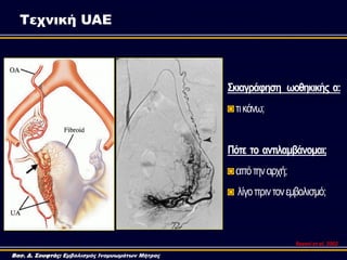 Σκιαγράθηζη ωοθηκικής α:
◙ηηθάλσ;
Πόηε ηο ανηιλαμβάνομαι;
◙απόηελαξρή;
◙ ιίγνπξηληνλεκβνιηζκό;
Τεχνική UAE
Βασ. Δ. Σουφτάς...