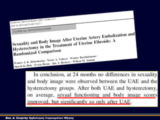 Βασ. Δ. Σουφτάς: Εμβολισμός Ινομυωμάτων Μήτρας
 