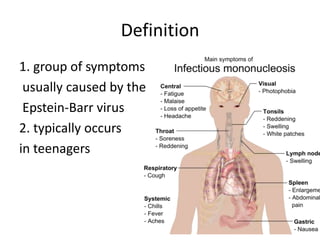Definition
1. group of symptoms
usually caused by the
Epstein-Barr virus
2. typically occurs
in teenagers
 