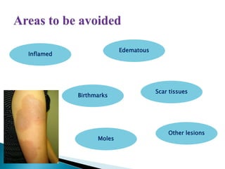 Inflamed
Edematous
Moles
Birthmarks
Scar tissues
Other lesions
 