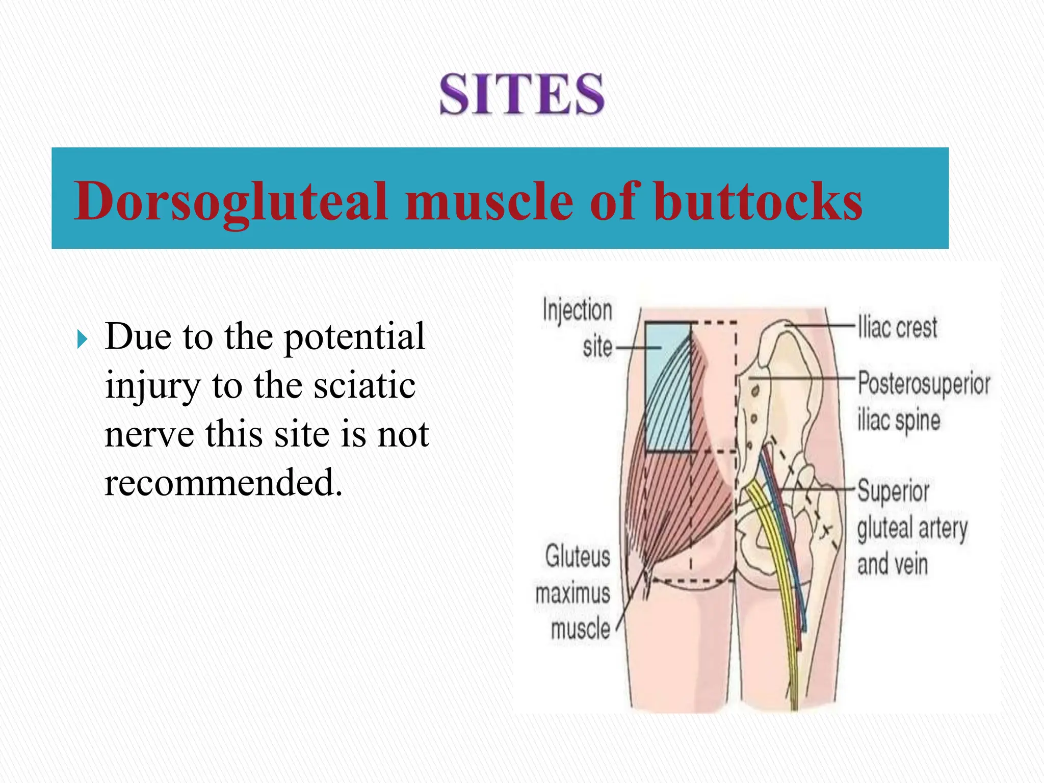 ntramuscular injectionpresentation...... | PPTX