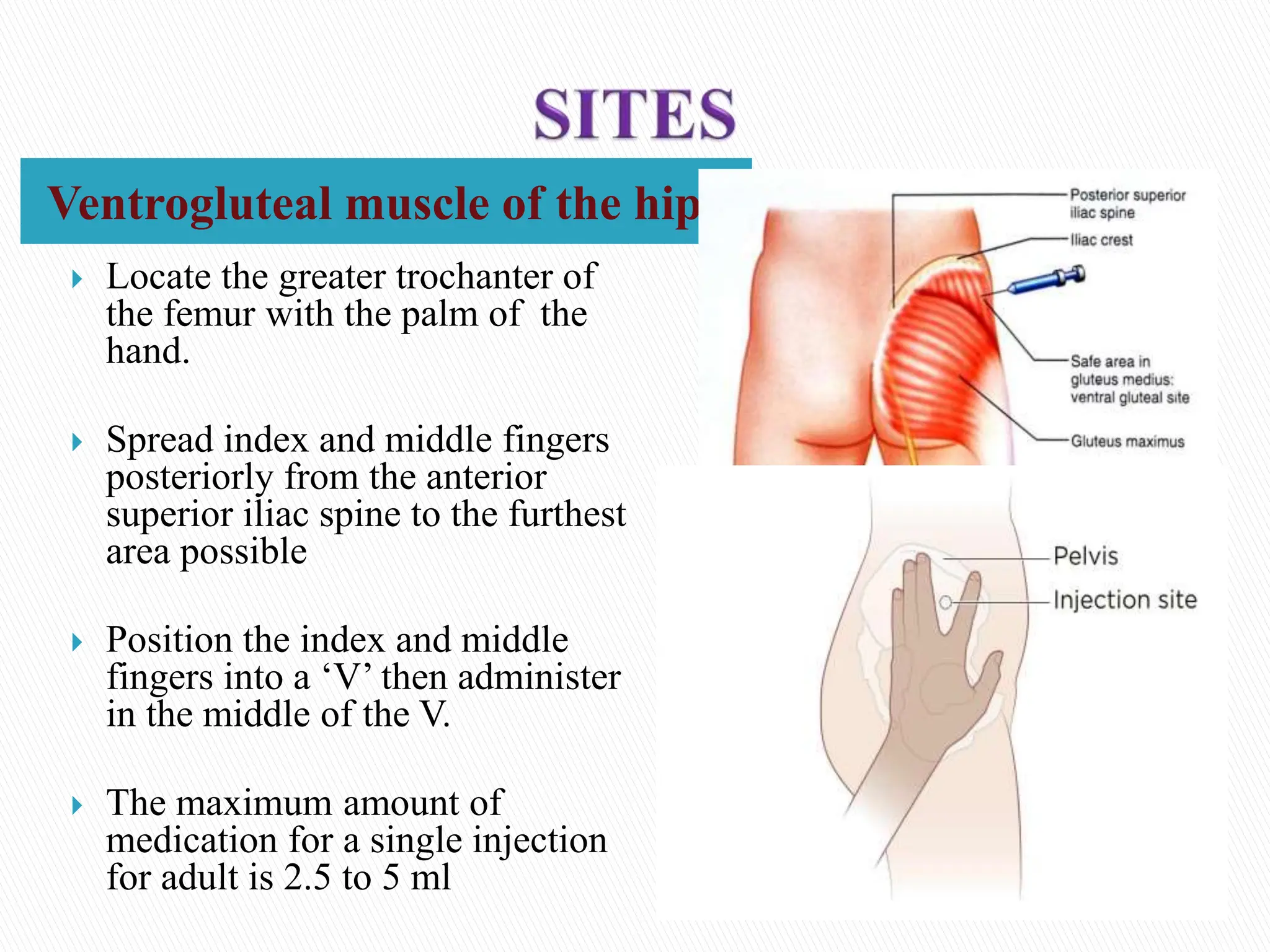 ntramuscular injectionpresentation...... | PPTX