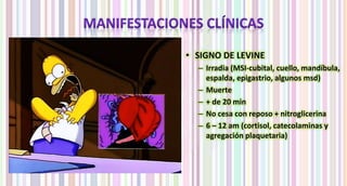 • SIGNO DE LEVINE 
– Irradia (MSI-cubital, cuello, mandíbula, 
espalda, epigastrio, algunos msd) 
– Muerte 
– + de 20 min 
– No cesa con reposo + nitroglicerina 
– 6 – 12 am (cortisol, catecolaminas y 
agregación plaquetaria) 
 
