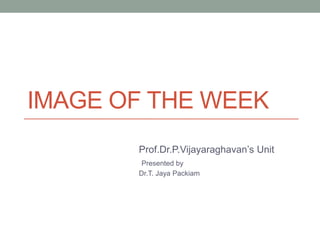 IMAGE OF THE WEEK
Prof.Dr.P.Vijayaraghavan’s Unit
Presented by
Dr.T. Jaya Packiam
 