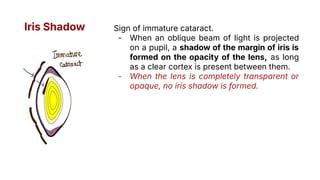 immature senile cataract iris shadow Images High... Image bank Lens cataract updated March 2026 .pdf