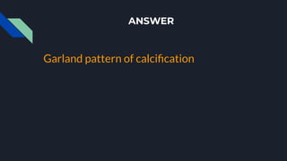 ANSWER
Garland pattern of calciﬁcation
 