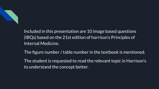 Included in this presentation are 10 image based questions
(IBQs) based on the 21st edition of harrison’s Principles of
Internal Medicine.
The ﬁgure number / table number in the textbook is mentioned.
The student is requested to read the relevant topic in Harrison’s
to understand the concept better.
 