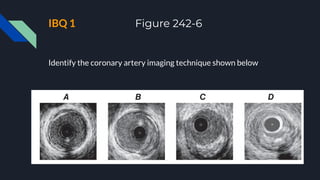 IBQ 1 Figure 242-6
Identify the coronary artery imaging technique shown below
 