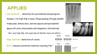 APPLIED
• Low Contrast : detection for periodontal and periapical
disease. { As high kVp is used, Xrays passing through smaller
trabeculae, lamina dura, marrow spaces and periodontal
space will carry discernable and diagnostic information}
 But, very high kVp, will cause loss of details- burn-out effect.
• High Contrast: detection of caries
• Grid: reduces scattered radiation reaching film.`
 