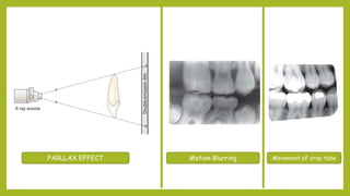 PARLLAX EFFECT Motion Blurring Movement of xray tube
 