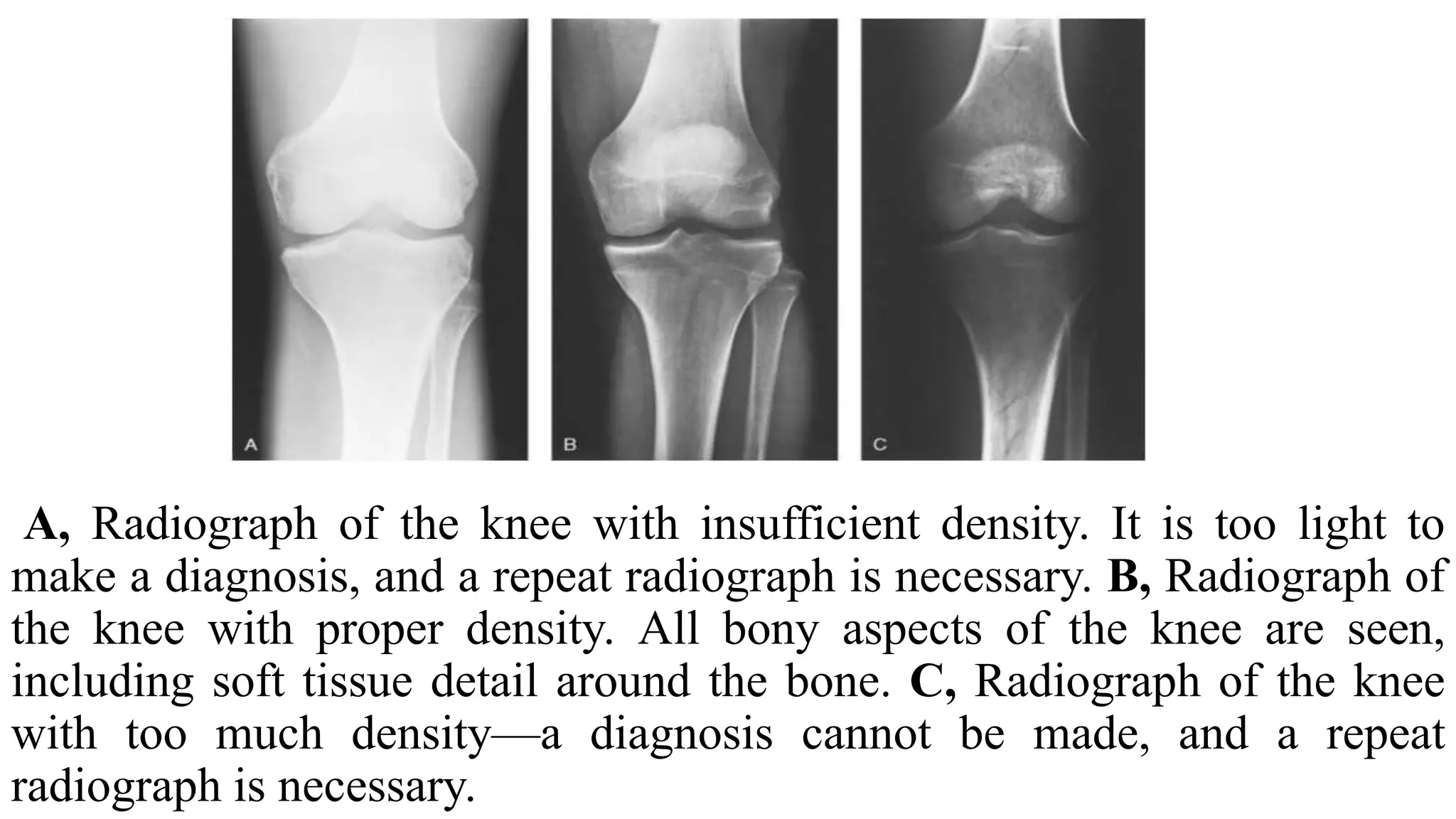 Image characteristics of x ray film | PPTX