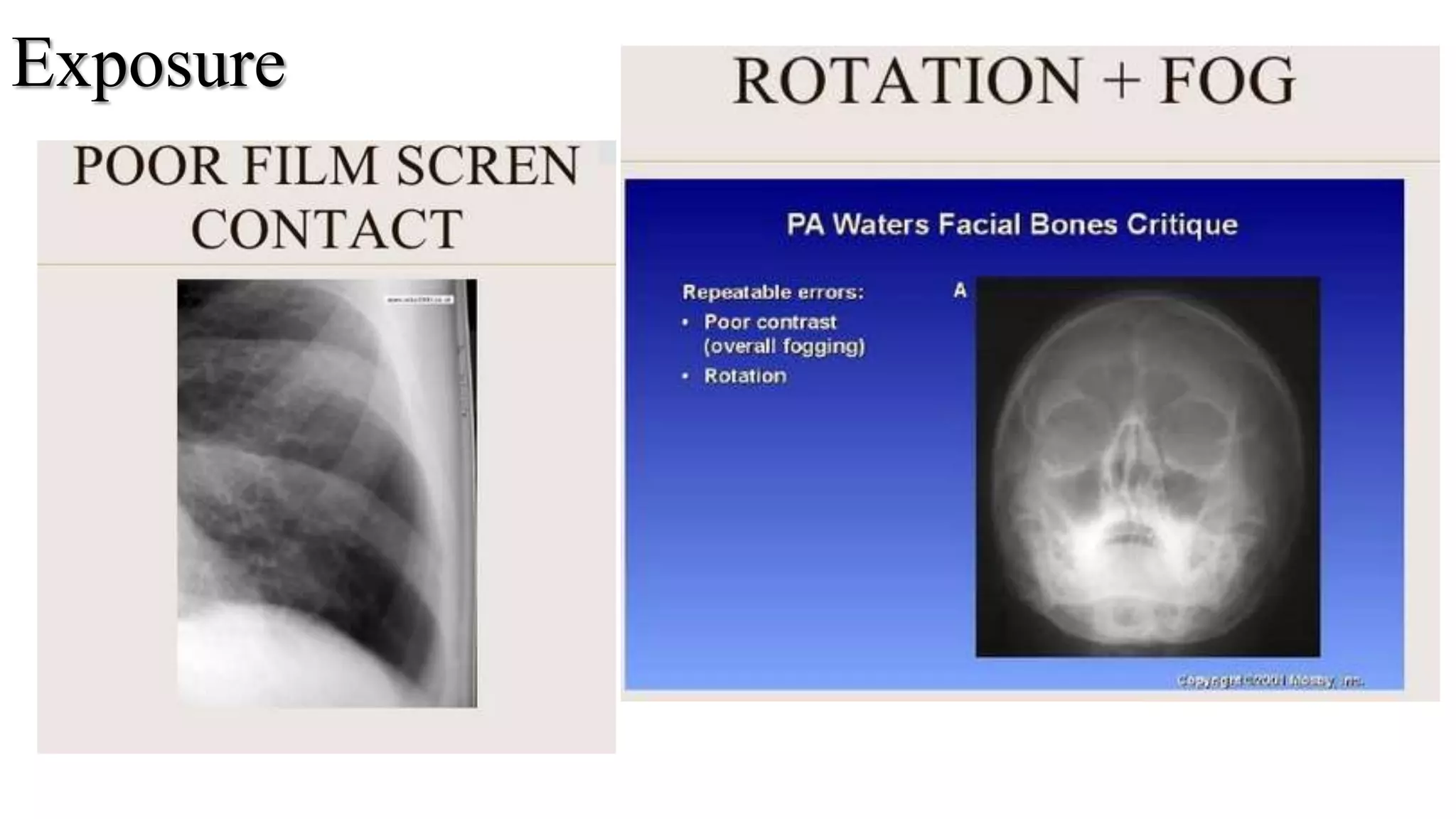 Inverted Radiographic Film Image characteristics of x ray film | PPTX