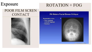 Film Fog In Radiography Image characteristics of x ray film | PPTX