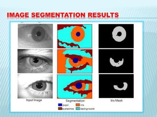 IMAGE SEGMENTATION RESULTS
 