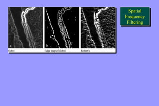 Spatial 
Frequency 
Filtering 
Spatial 
Frequency 
Filtering 
 