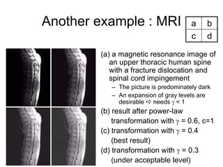 Another example : MRI
(a) a magnetic resonance image of
an upper thoracic human spine
with a fracture dislocation and
spinal cord impingement
– The picture is predominately dark
– An expansion of gray levels are
desirable  needs  < 1
(b) result after power-law
transformation with  = 0.6, c=1
(c) transformation with  = 0.4
(best result)
(d) transformation with  = 0.3
(under acceptable level)
a b
c d
 