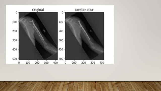 Image Enhancement Techniques using OpenCV – Python.pptx