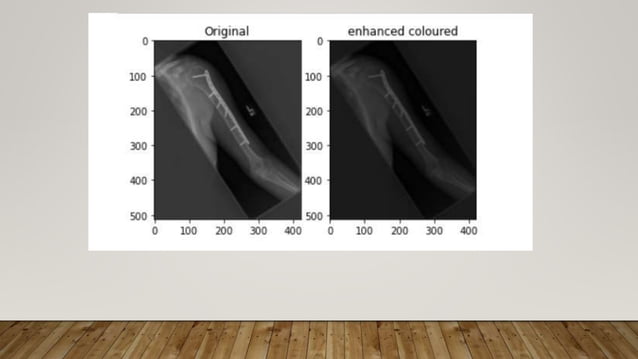 Image Enhancement Techniques using OpenCV – Python.pptx