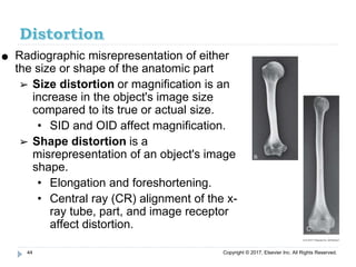 Size Distortion Radiograph Image formation & rad quality | PDF