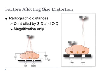 Size Distortion Radiograph Image formation & rad quality | PDF