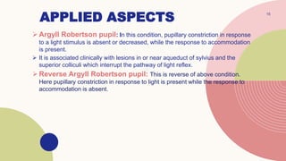 APPLIED ASPECTS
Argyll Robertson pupil: In this condition, pupillary constriction in response
to a light stimulus is absent or decreased, while the response to accommodation
is present.
 It is associated clinically with lesions in or near aqueduct of sylvius and the
superior colliculi which interrupt the pathway of light reflex.
Reverse Argyll Robertson pupil: This is reverse of above condition.
Here pupillary constriction in response to light is present while the response to
accommodation is absent.
15
 