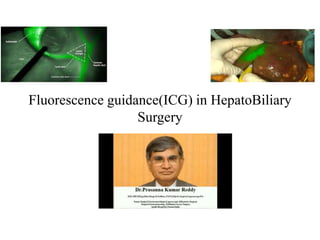 Fluorescence guidance(ICG) in HepatoBiliary
Surgery
 