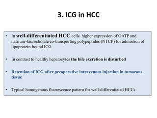 Role of Image guidance in THE HPB surgery.pptx