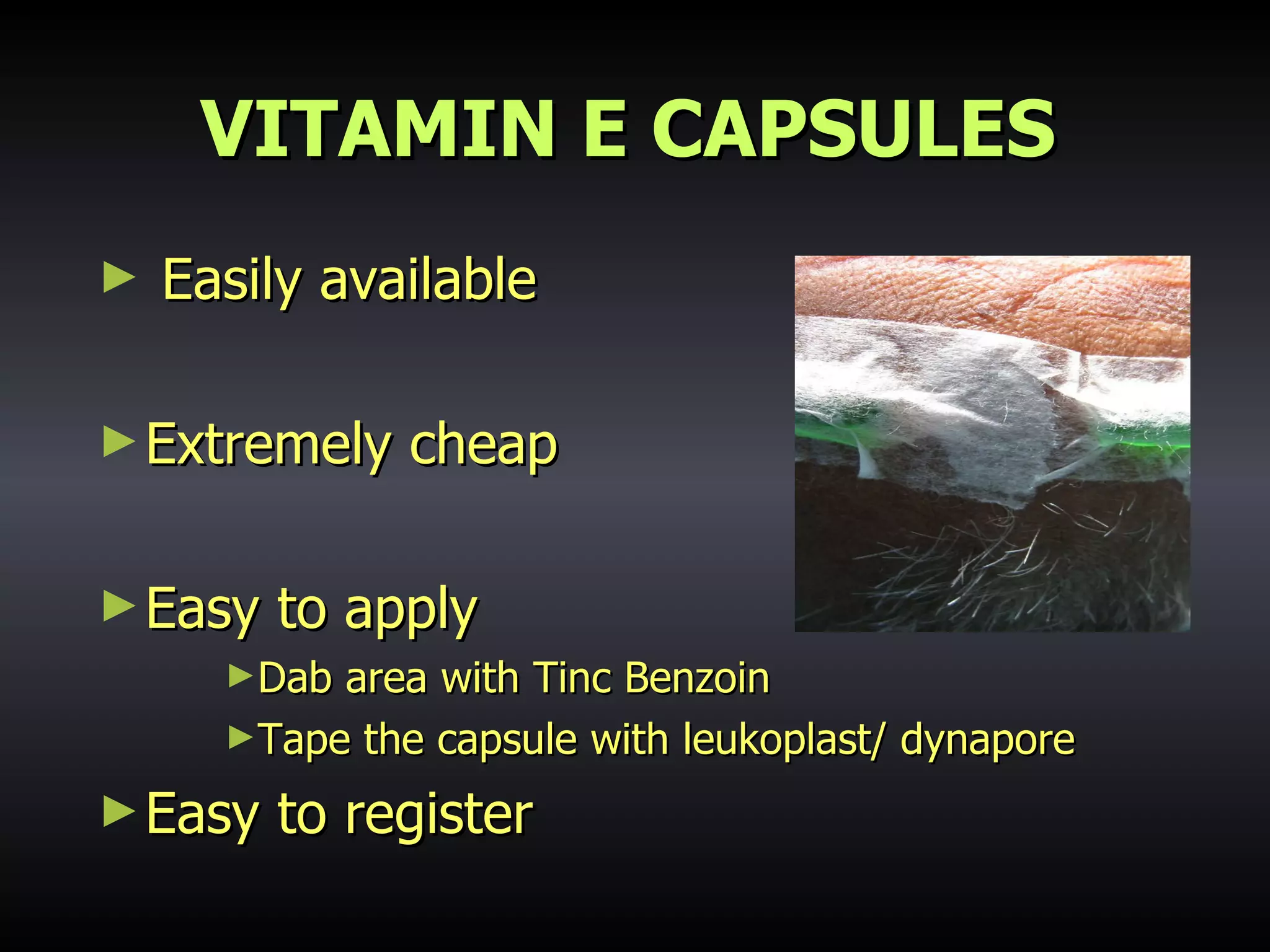 VITAMIN E CAPSULES Easily available Extremely cheap Easy to apply Dab area with Tinc Benzoin Tape the capsule with leukoplast/ dynapore Easy to register 