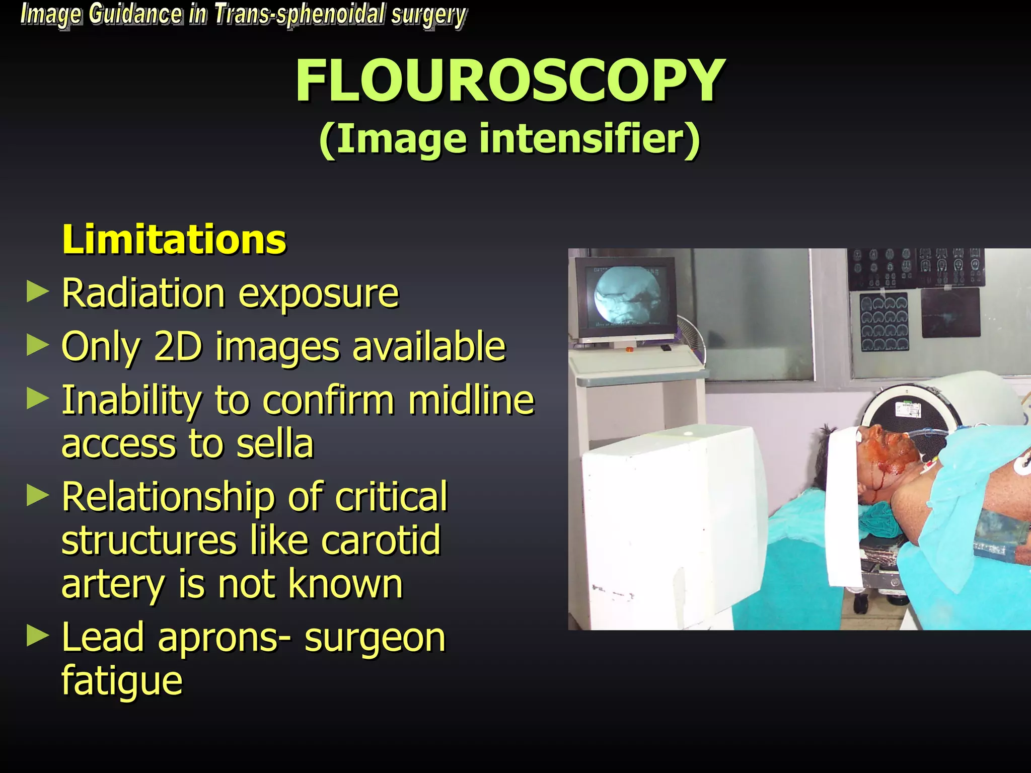 FLOUROSCOPY (Image intensifier) Limitations Radiation exposure Only 2D images available Inability to confirm midline access to sella Relationship of critical structures like carotid artery is not known Lead aprons- surgeon fatigue Image Guidance in Trans-sphenoidal surgery 