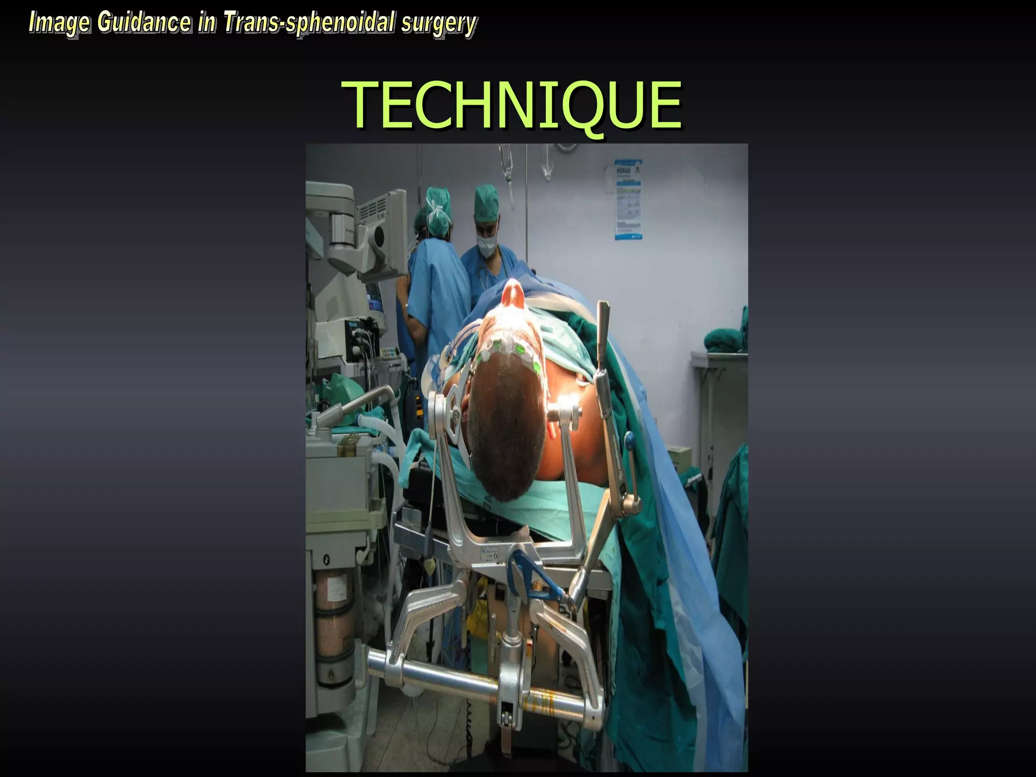 TECHNIQUE Image Guidance in Trans-sphenoidal surgery 