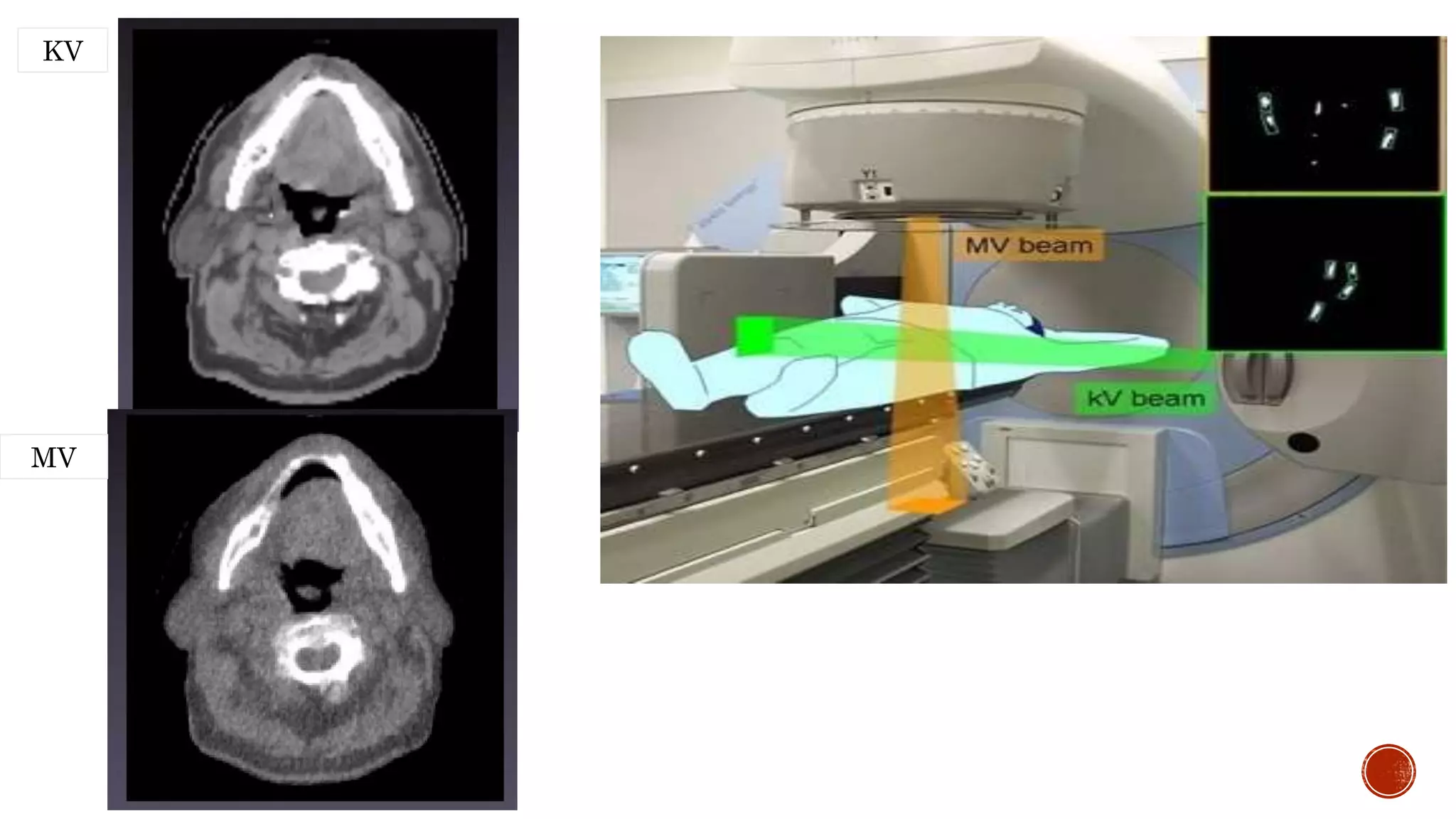 Image guided radiation therapy | PPTX