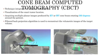  Technique integrates CT imaging with LINAC.
 Visualization of the exact tumor location.
 Acquiring multiple planar images produced by KV or MV cone beam rotating 360 degrees
around the patient.
 Filtered back projection algorithm is used to reconstruct the volumetric images of the target
volume.
 