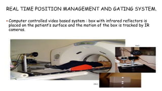  Computer controlled video based system : box with infrared reflectors is
placed on the patient’s surface and the motion of the box is tracked by IR
cameras.
 