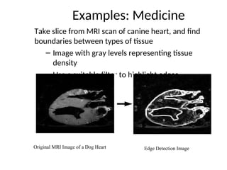 Examples: Medicine
Take slice from MRI scan of canine heart, and find
boundaries between types of tissue
– Image with gray levels representing tissue
density
– Use a suitable filter to highlight edges
Original MRI Image of a Dog Heart Edge Detection Image
 