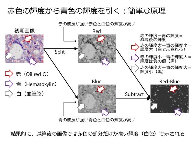 Image J を用いた組織像の定量解析