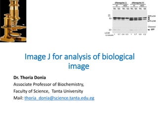 Image J for analysis of biological
image
Dr. Thoria Donia
Associate Professor of Biochemistry,
Faculty of Science, Tanta University
Mail: thoria_donia@science.tanta.edu.eg
 
