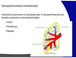 Compartimentos intersticiais:
Interstício pulmonar é composto por 3 compartimentos de
tecido conjuntivo interrelacionados:
•Axial
•Periférico
•Septal
 