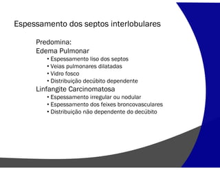 Espessamento dos septos interlobulares
Predomina:
Edema Pulmonar
• Espessamento liso dos septos
• Veias pulmonares dilatadas
• Vidro fosco
• Distribuição decúbito dependente
Linfangite Carcinomatosa
• Espessamento irregular ou nodular
• Espessamento dos feixes broncovasculares
• Distribuição não dependente do decúbito
 
