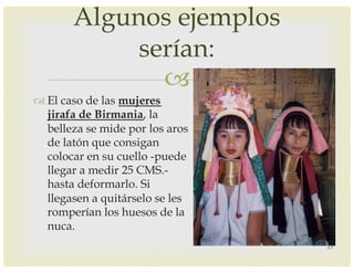–
™ El caso de las mujeres
jirafa de Birmania, la
belleza se mide por los aros
de latón que consigan
colocar en su cuello -puede
llegar a medir 25 CMS.-
hasta deformarlo. Si
llegasen a quitárselo se les
romperían los huesos de la
nuca.
Algunos ejemplos
serían:
15
 
