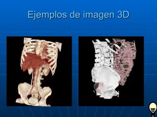 Ejemplos de imagen 3D 