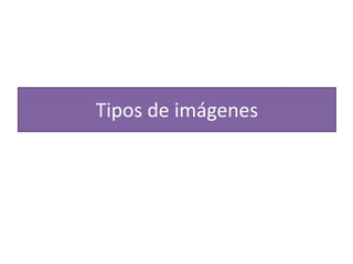 Tipos de imágenes
 