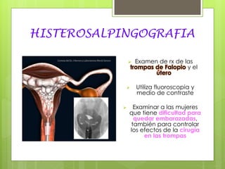 HISTEROSALPINGOGRAFIA
 Examen de rx de las
trompas de Falopio y el
útero
 Utiliza fluoroscopia y
medio de contraste
 Examinar a las mujeres
que tiene dificultad para
quedar embarazadas,
también para controlar
los efectos de la cirugía
en las trompas
 