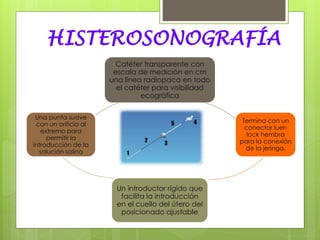HISTEROSONOGRAFÍA
Catéter transparente con
escala de medición en cm
una línea radiopaca en todo
el catéter para visibilidad
ecográfica
Termina con un
conector luer-
lock hembra
para la conexión
de la jeringa.
Un introductor rígido que
facilita la introducción
en el cuello del útero del
posicionado ajustable
Una punta suave
con un orificio al
extremo para
permitir la
introducción de la
solución salina
 