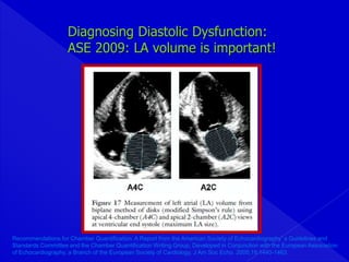 Imagen en Insuficiencia Cardiaca | PPTX