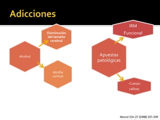 IRM
          Disminución                 Funcional
          del tamaño
            cerebral



Alcohol                  Apuestas
                        patológicas

             Atrofia
             cortical

                                        -Cuerpo
                                        calloso
 