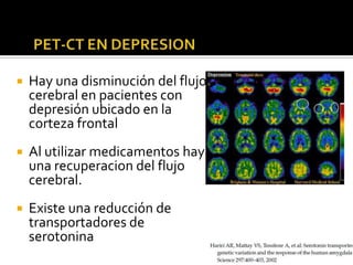    Hay una disminución del flujo
    cerebral en pacientes con
    depresión ubicado en la
    corteza frontal
   Al utilizar medicamentos hay
    una recuperacion del flujo
    cerebral.
   Existe una reducción de
    transportadores de
    serotonina
 