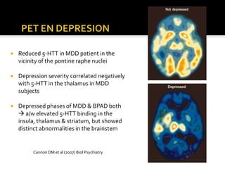    Reduced 5-HTT in MDD patient in the
    vicinity of the pontine raphe nuclei

   Depression severity correlated negatively
    with 5-HTT in the thalamus in MDD
    subjects

   Depressed phases of MDD & BPAD both
     a/w elevated 5-HTT binding in the
    insula, thalamus & striatum, but showed
    distinct abnormalities in the brainstem


         Cannon DM et al (2007) Biol Psychiatry
 
