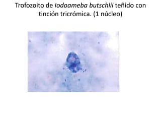 Trofozoito de Iodoameba butschlii teñido con
        tinción tricrómica. (1 núcleo)
 