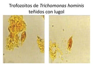 Trofozoitos de Trichomonas hominis
         teñidos con lugol
 
