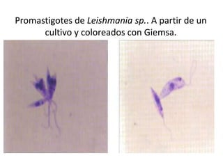 Promastigotes de Leishmania sp.. A partir de un
      cultivo y coloreados con Giemsa.
 